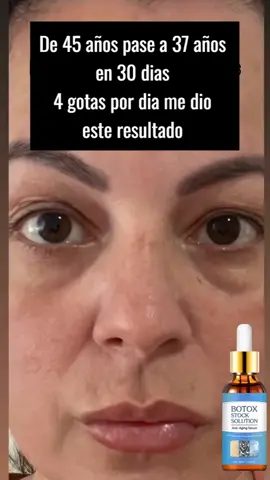 Botox Stock Solution – Sérum Antiedad Reafirmante para una Piel Radiante 🔥PROMOCION 2 X 1 LLEVA GRATIS UNA UNIDAD ADICIONAL🔥