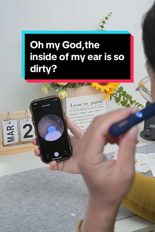 This ear scoop with a camera and light lets you see everything inside your ear clearly and get it out precisely.My girlfriend loves using it to clean her ears.#earwax #tool #earwaxremoval #earclean 