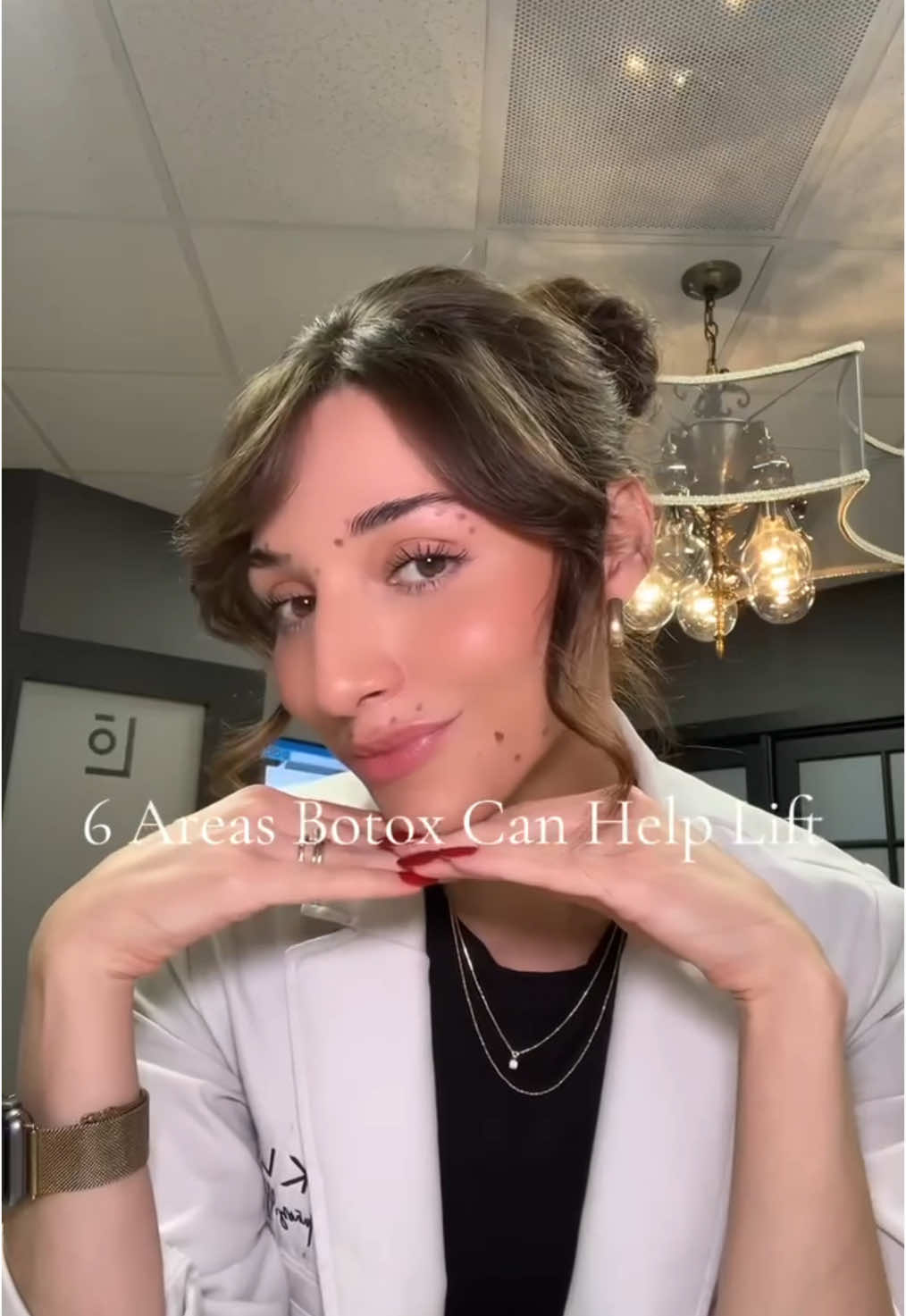 6 Areas Botox Can Help Lift with @Kennedy | Aesthetic Injector 💉✨ #botox #browlift #nosejob #rbfchallenge #botoxcheck #scottsdaleaz #azmedspa #howtolookyounger 