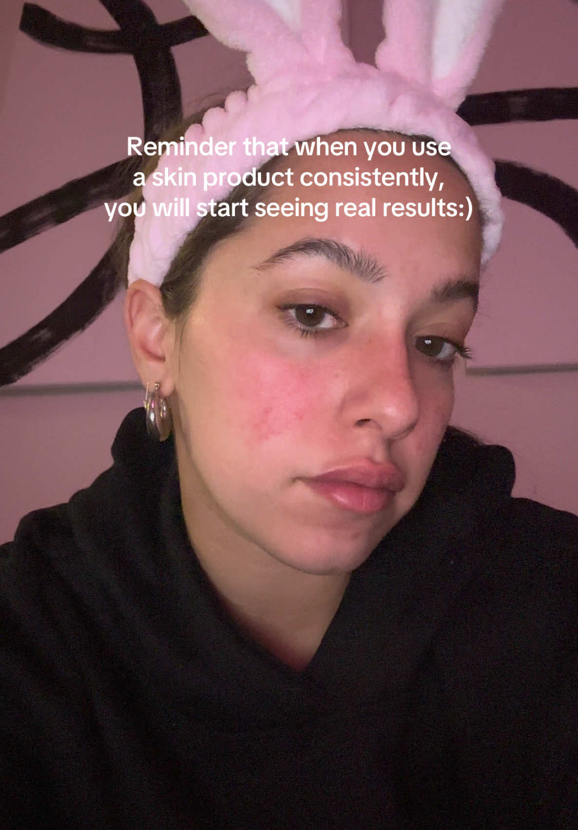 My skin has gone through it but I found the product that works for me and I have been using it every night. It gets better every day 😌 #ttshop #medicube #glowupchallenge 