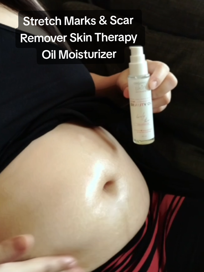 Organic Skin Japan Intimate Beauty Oil 60ml with Vitamin E for Stretch Marks & Scar Remover Skin Therapy Oil Moisturizer Stretchmarks Sunflower Oil Essential Oil Lighten Scars Remover #organicskinbeautyoil #organicskinjapan #therapyoil #oil #sunfloweroil #moisturizer #stretchmarks #remover #mom #mommy #pregnant #preggymommy #mama #materna 