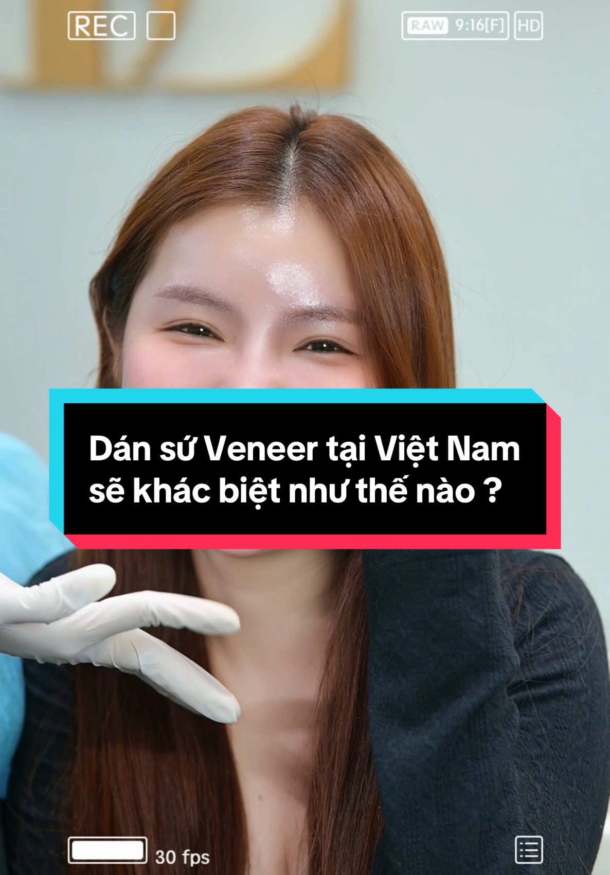 Cô bé khách nguời nước ngoài bay từ #cambodia về thay lại bộ dán sứ mới #Veneer #siêumỏng #Siêutrong #siêutựnhiên #bảotồnrăngthật 🦷 Mng thấy from răng và màu sắc bs tại #việtnam🇻🇳💪 mình làm đẹp hơn các nước khác không ạ 📍 #joxythuylinh #Răngkhểnh #nucuoixinh #nucuoixinh #thammyrangsudep #làmđẹp 