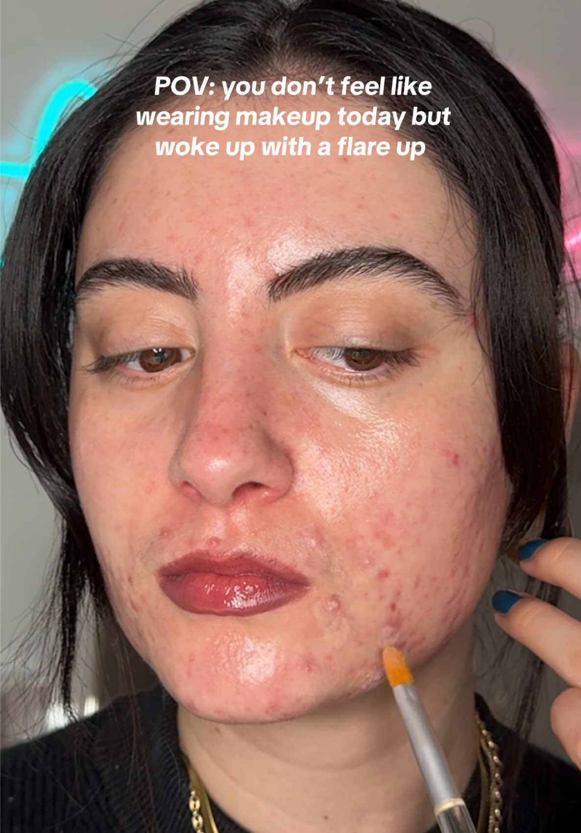 My version of no makeup makeup 🥰 using @Makeup Revolution irl concealer and @bareMinerals powder foundation. My skin chose violence after my flight back to Canada 😭 #realskintexture #skincareroutine #acnepositivity #hormonalacne #beautytips 