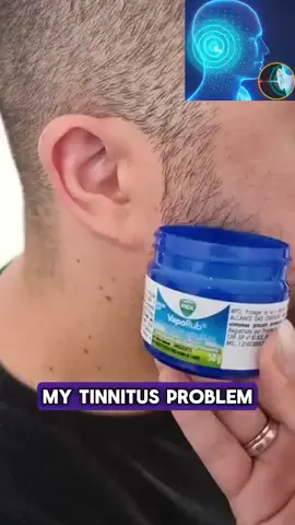 Check the link in bio for more! 🔗 #tinnitusrelief #tinnitusmanagement #healthtip #ringingear #hearinghealth #viralvideo #fy #earmassage #tinnitusprevention #tinnitusproblems #ringingears #ears #painrelief #ringing #ringinginears