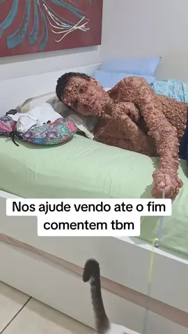 Nos ajude vendo até o fim !! @felipegoncalves10441  #ajuda #family #viral #gato #fyp #doencasrara #Deusabençoeatodos 
