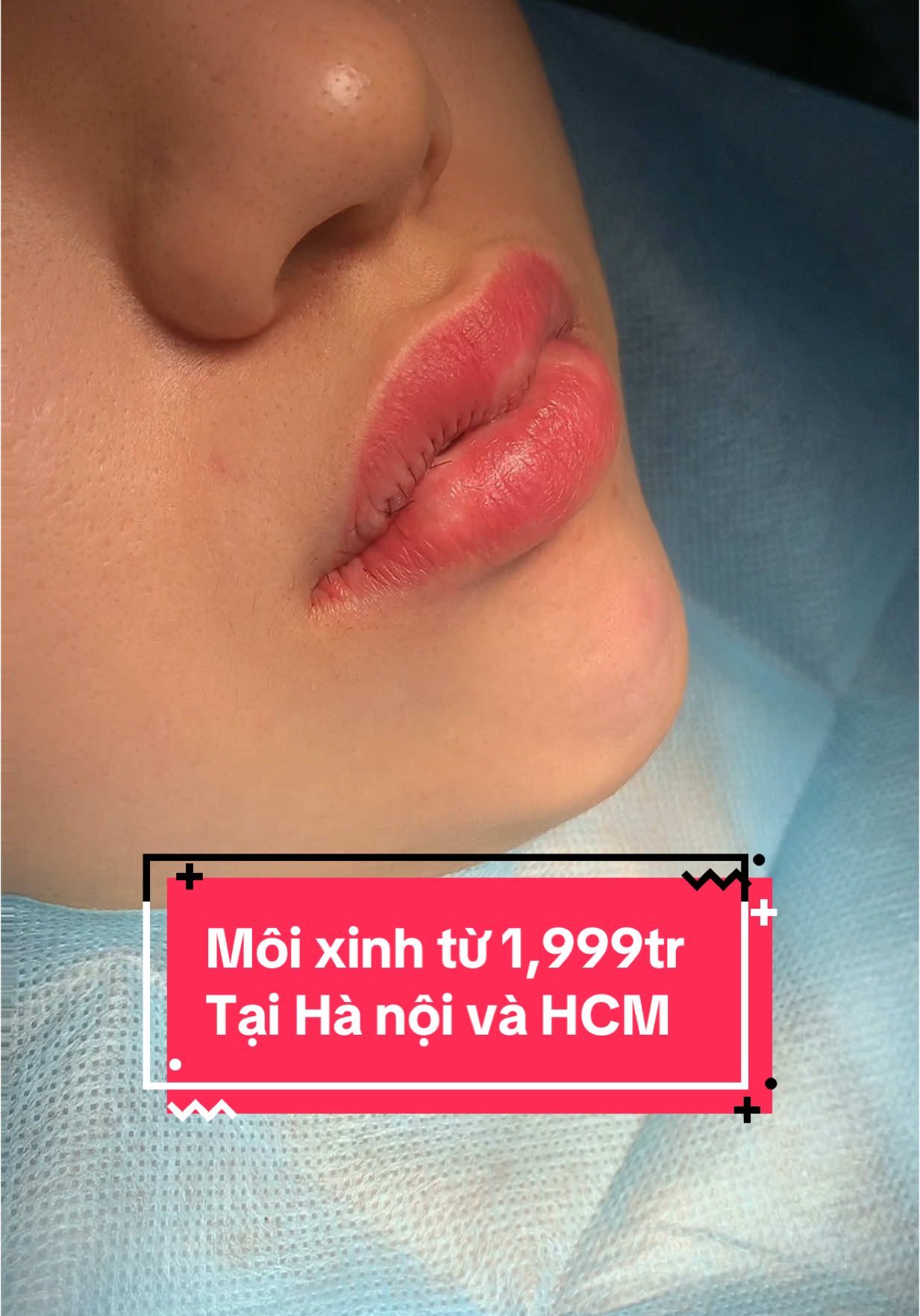 Môi xinh từ 1,999tr Tại Hà nội và HCM#hottrend #catmoidep #cătmoitim #nhấnmiplasma #hottrendtiktok #cătmoitim 