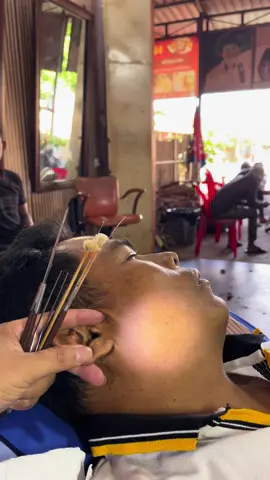 #earwaxremoval #cleaning #asmr #wax #removal #fowllo #earwax @Earwax.Cleaning @siha12288 @Removal cleaning 