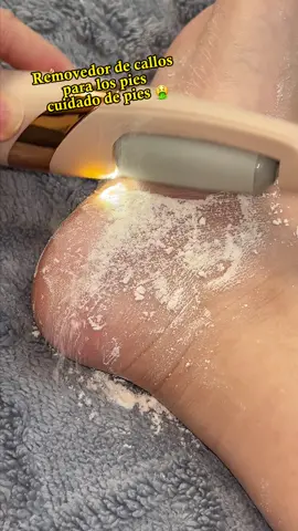 Removedor de callos para los pies, cuidado de pies.🦶 #removedordecallos #pedicure  #TikTokShopLoveAtFirstFind #spotlightfinds #footfile #footcare