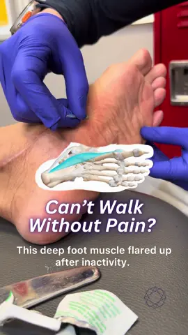🏆 Foot Pain Reset: Dry Needling + Shockwave ▪️ What it does: A deep intrinsic foot muscle became aggravated after inactivity. Dry needling calms irritated nerves, while shockwave boosts circulation and breaks up scar tissue. ▪️ The benefits: Relief from foot pain, restored function, and accelerated healing. ▪️ Who it’s for: Anyone dealing with stubborn foot pain, post-injury tightness, or chronic inflammation. #FootPainRelief #DryNeedling #ShockwaveTherapy #MobilityRecovery #SportsChiropractor #ChicagoChiropractor #DrKyleRoss #ChiropracticCare #ActiveRecovery #RoscoeVillage #WickerPark #RiverWest #Lakeview #Streeterville
