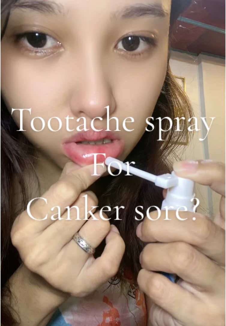 Toothache spray for canker sore? Pwede pala haha. Instant reloef pala nakakain pa ako ng maanghang 😅 #cankersore #cankersorerelief #cankersoreremedy 