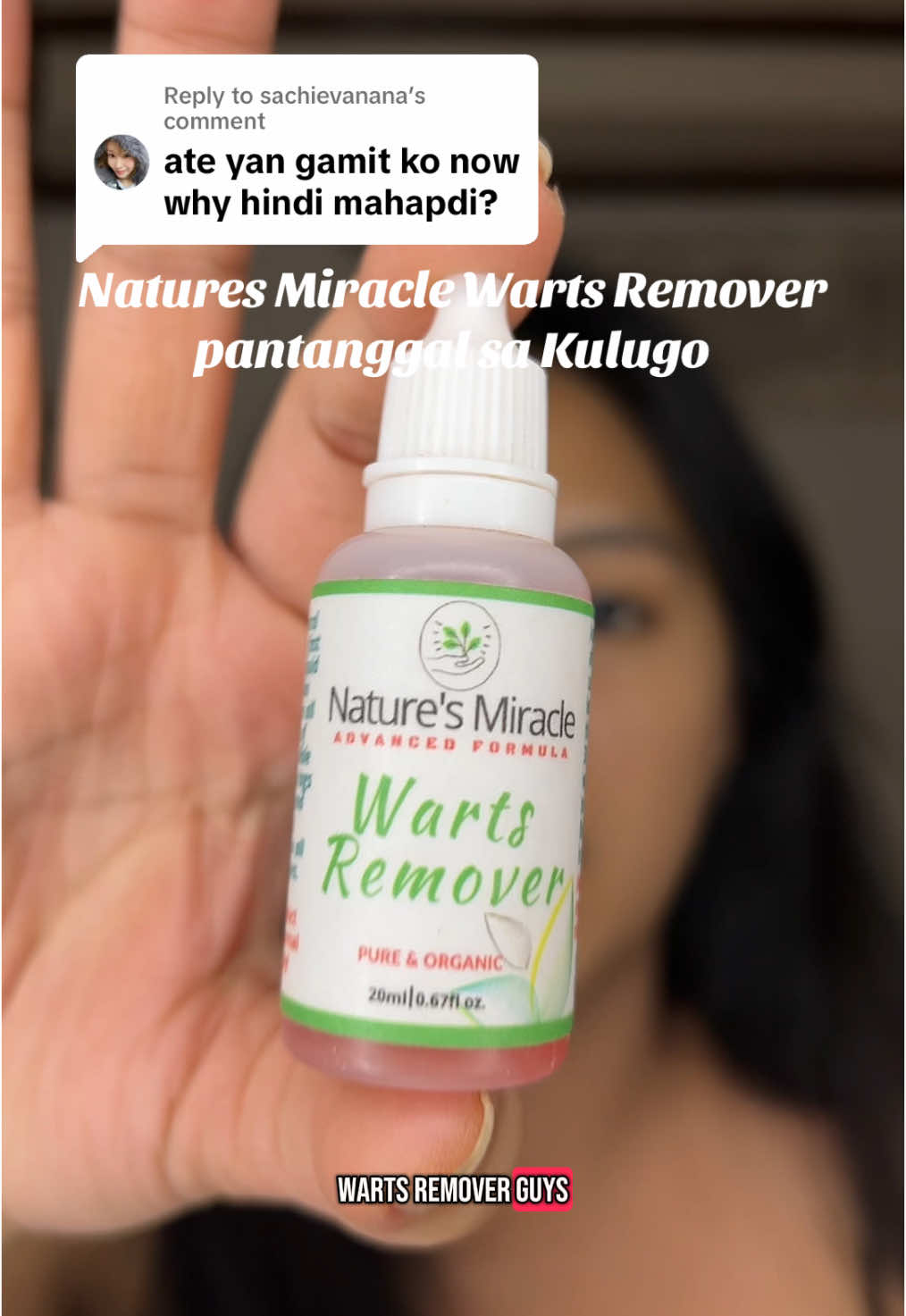 Replying to @sachievanana sugatan niyo po muna yung kulugo niyo bago lagyan ng warts remover para mas masunog yung kulugo at di na bumalik #kulugo #kulugoremover #kulugosakamay #wartsremoval #wartsremover #naturesmiraclewartsremoval 