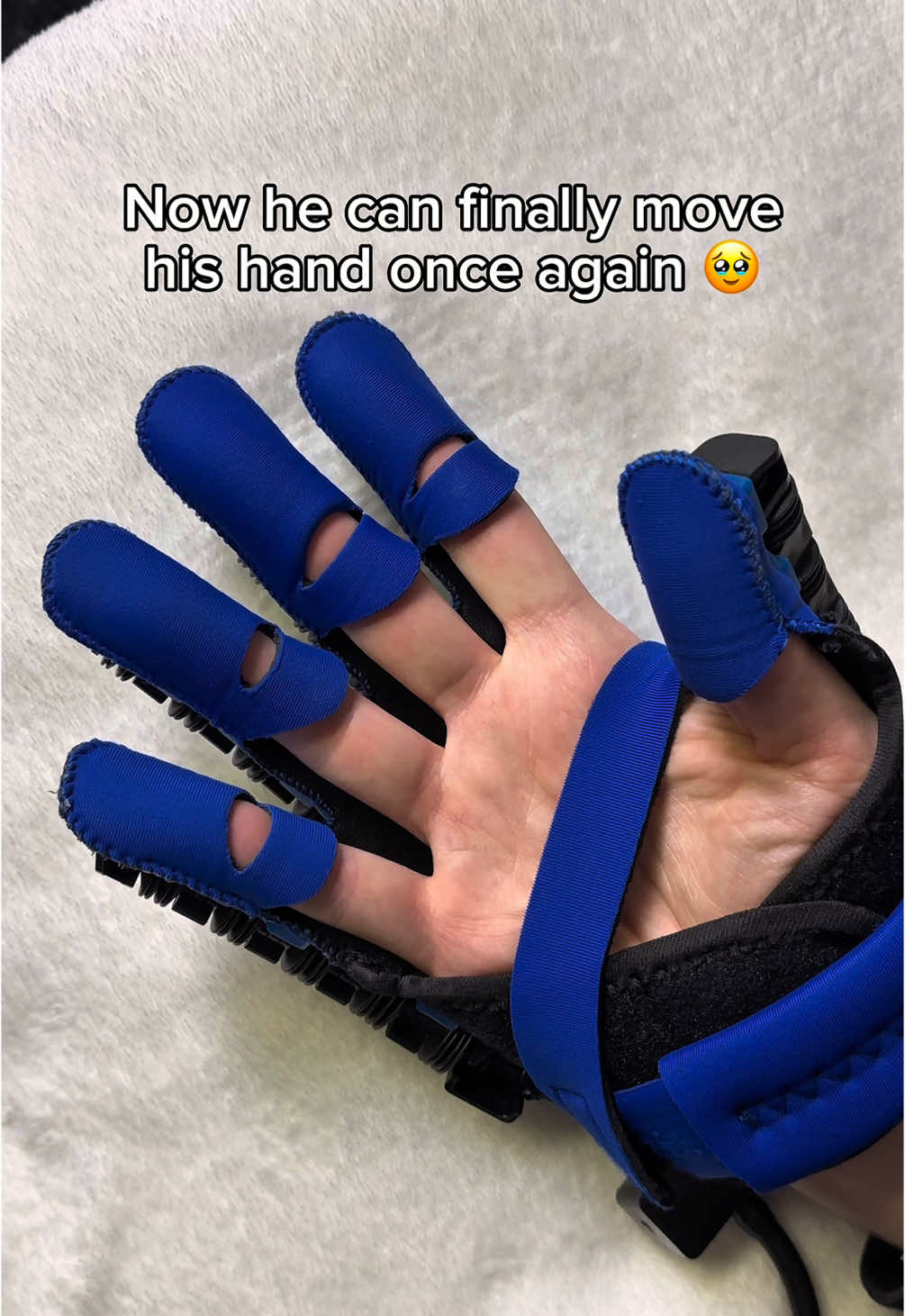 He can finally move his hand again 🥹❤️‍🩹 #stroke #recovery #strokesurvivor #arthritis #mobilityaid #strokeawareness 