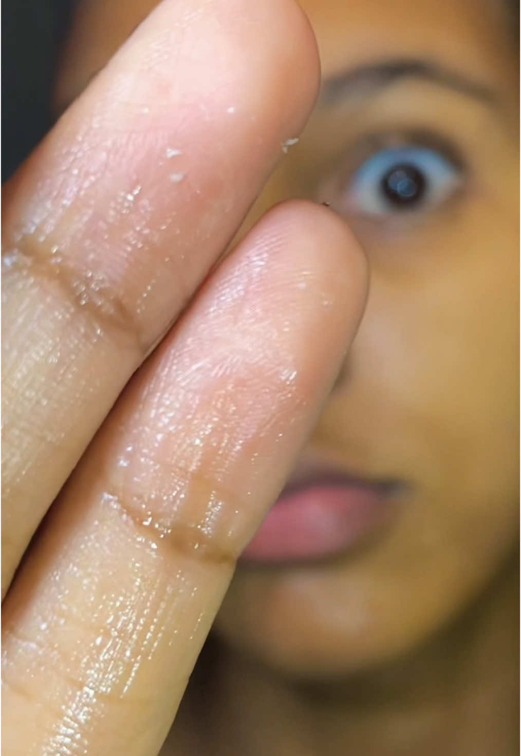 This trick consists of always softening the skin with it for better cleaning.✨🪄@SAM’U  #skinshed #texture #pores #sebum #cloggedpores #samuskincare #samu #galactopore #kbeautyskincare #amazonfinds 