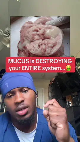 You’re clogged up 