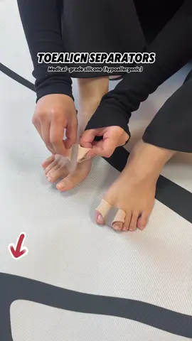 Improve leg shape, first adjust the hallux valgus and stick to wearing it #MangaLeg #ToeDivider#ttslevelup#TikTokShopSpringGlowUp#TikTokMadeMeBuyIt#ShopVideoCarnival
