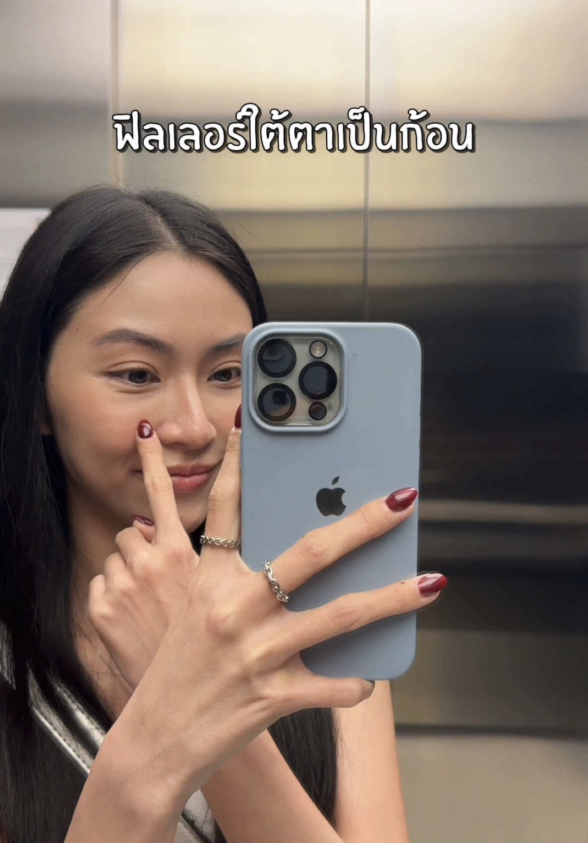 เรื่องนี้สอนให้รู้ว่าฉีดฟิลเลอร์การเลือกคลีนิคสำคัญมาก🥹🩵  #glowithice #ฟิลเลอร์ #ฟิลเลอร์ใต้ตา #ฟิลเลอร์เป็นก้อน #หัตถการ @The Loft Clinic 