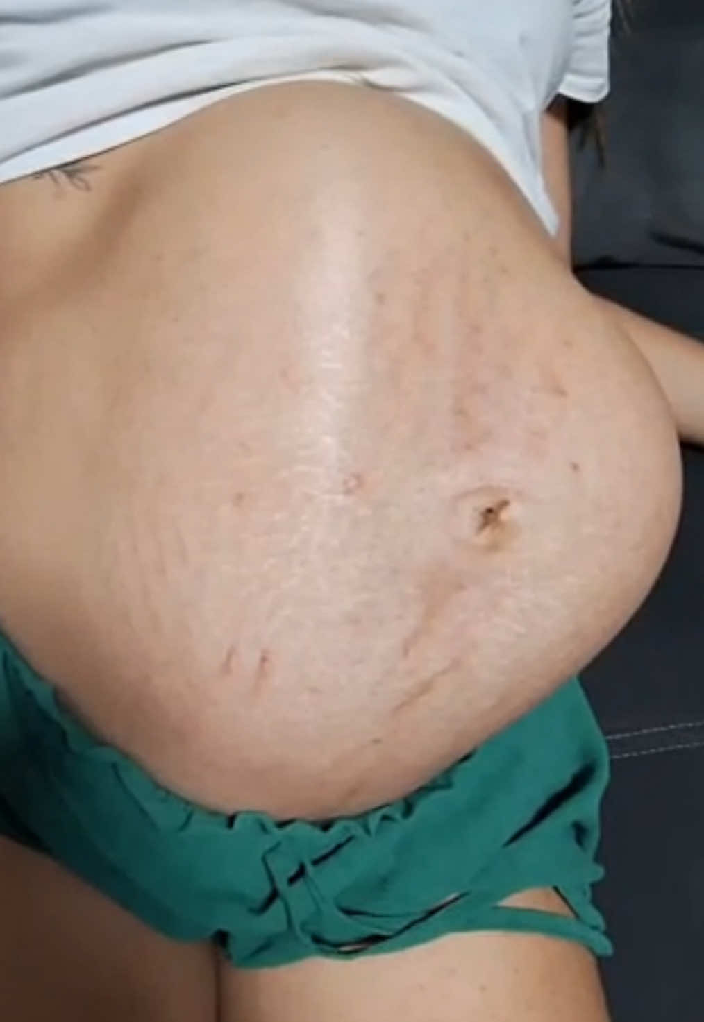 E por aqui estamos assim 🫠 Contrações de treinamento.. 37 Semanas hoje  #gravidez #gemeos #gravidadegemeos #fyp #parir #gestante #contracaodetreinamento 