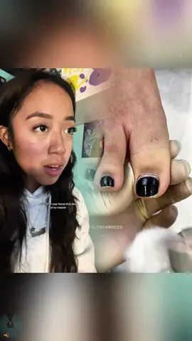 Remove toenails #ingrownhair #hairplucking #ingrowneyelash #lashes #eyemucous #CleanTokCrazy #cleanmakeup #satisfyingvideo #asmr #eyemucous #cleaneyes #eyecleaning #sinkcleaningasmr #satisfying #asmrsound #asmr #cleanma #fypage #fypシ° #foryou #funny #skit #comedy #pov #fyp #foryou #tiktok #relatable