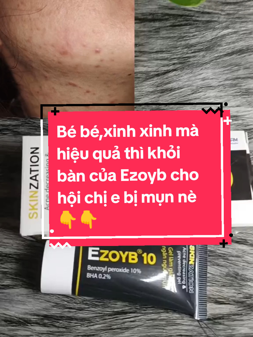 Gel giúp làm giảm mụn ezoyb5/ezoyb10#muasam #hottrendtiktok #ttlktiktokshop 