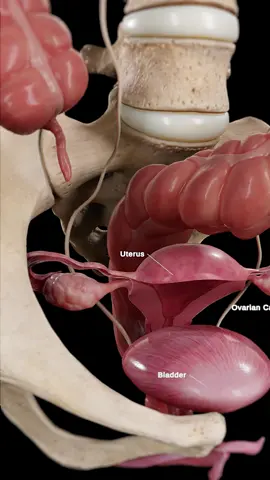🎗 Ovarian Cancer: Often Missed, Always Serious Watch how ovarian cancer starts deep in the pelvis and spreads silently. Our 3D animation shows the anatomy and the risks. #OvarianCancer #MedicalAnimation #WomensHealth #Anatomy #medical #meded #3d #unity3d #3dmodel #zbrush #sciart #medart #medstudent #anatomy #animation