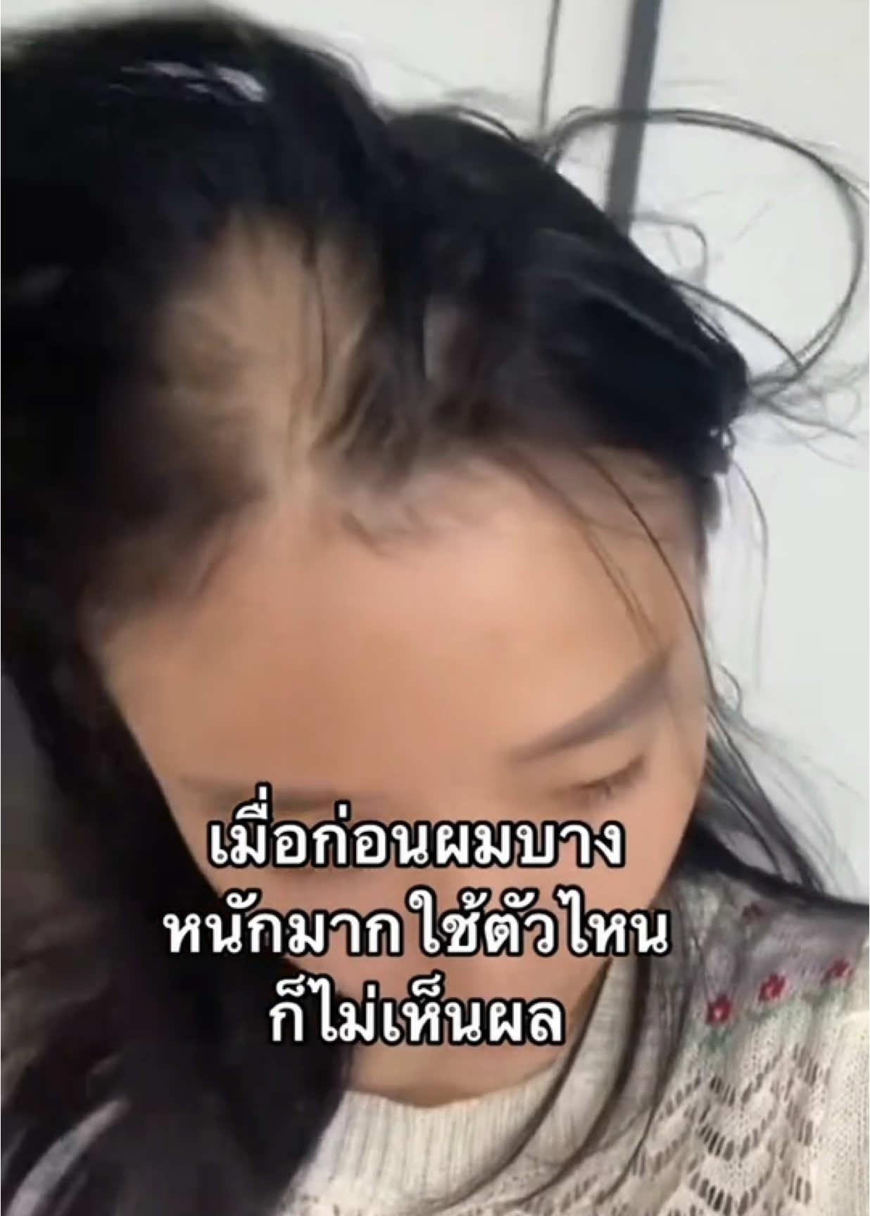 เป็นผู้หญิงอย่าหยุดสวยนะ #พิกัดตะกร้าหน้าโปรไฟล์ #ผมร่วง #เซรั่มปลูกผม #โทนิคชบา #แชมพูชบา #ผมดกผมหนา #fyp 