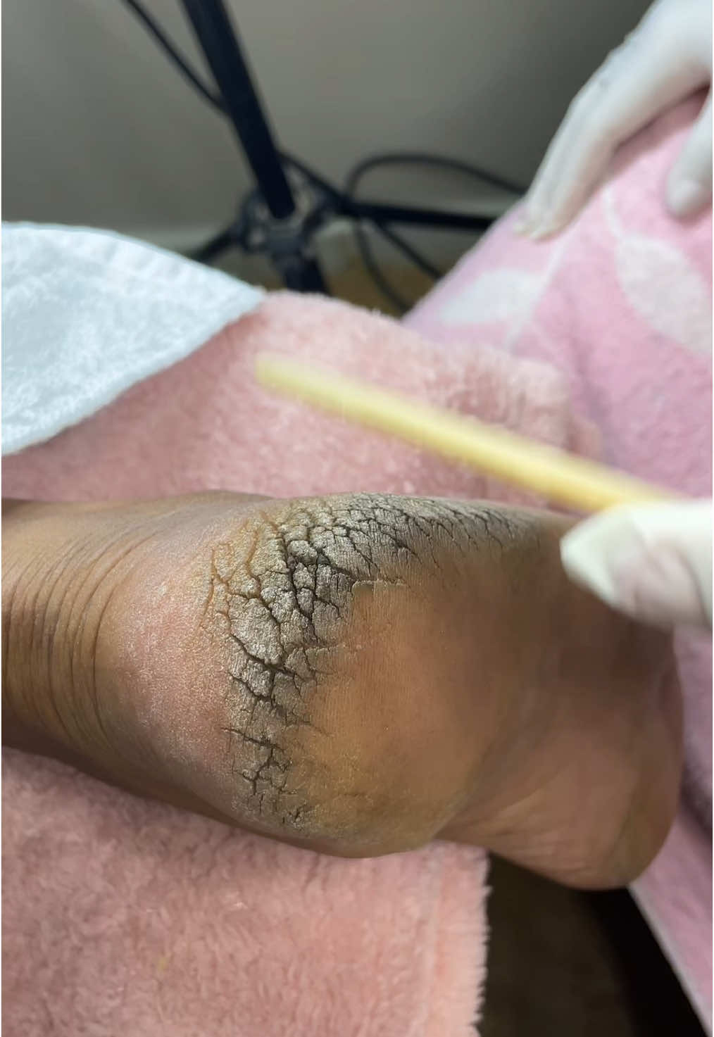 Procedimento plástica dos pés #plasticadospés👣 #pessaudaveis #manicures #arms 