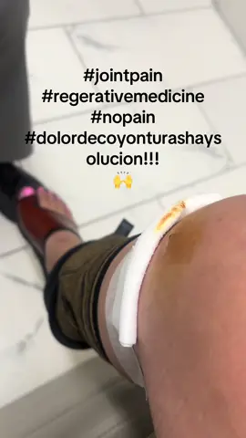 #cit #stemcelltherapy #jointpain #growthfactors #laser #aesthetics #medicinaregenerativa #skin #rejuvenation #filler #dermalfillers #regenerativetherapy #lipfillers #injectables #sculptra #functionalmedicine #biologics #chemicalpeel #cdd #lipfiller #medicinaregenerativa #blackfriday #laserhairremoval #morpheus #laserresurfacing #wellness #skintightening #skinbooster #painsolutions  #facials