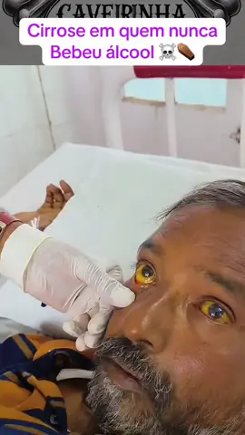 Ma alimentação diabetes automedicação pode causar cirrose ☠️⚰️ #consciencia #saude #cirrose #figado #figadogorduroso #tiktoksaude #medico #hospital 
