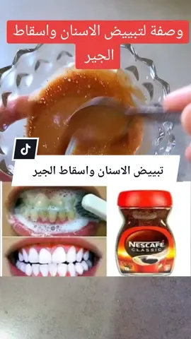 #وصفة لتبييض الاسنان واسقاط الجير #وصفة-تبييض#الاسنان#واسقاط#الجير-وصفة#مجربة#وسهلة#وصفاتي#طبيعية#france🇫🇷 #foeyoupage #ffoeyoupage #الشعب_الصيني_ماله_حل😂😂 