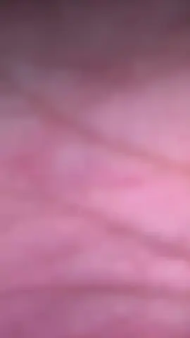 physical attack dia mah🥲 #fyp 