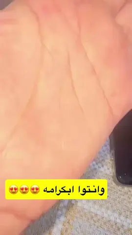 استخراج شوكه من القدم او اليد ✨