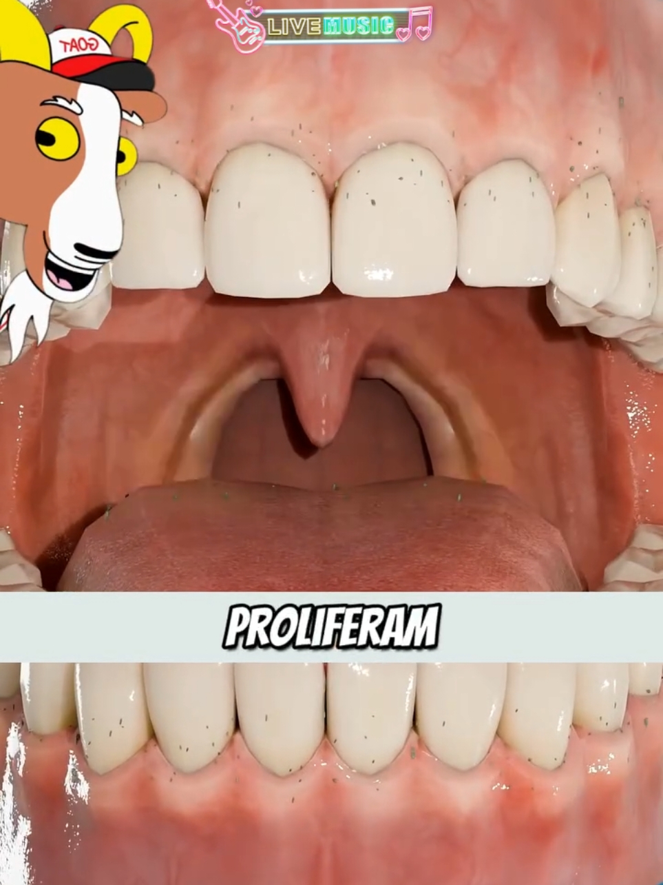 Por que ficamos com mau hálito quando acordamos ? 🤔 