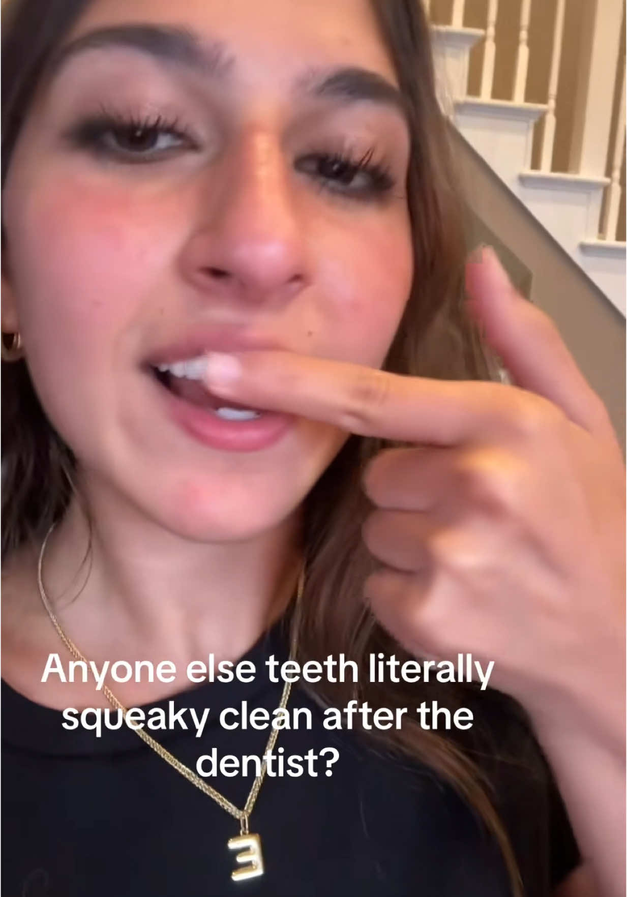 Why Are Her Teetn SQEAKING?! 😭🦷 #teeth #braces #dentist 