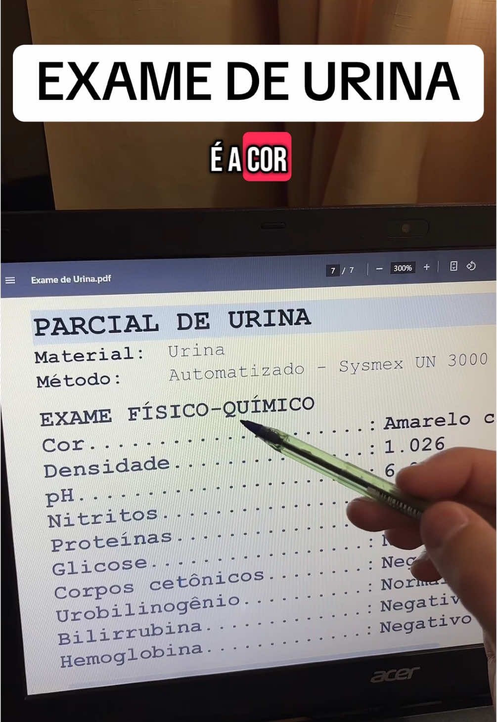 🔬🩸EXAME de URINA!!! #exame #urina #infeccao #bacterias 