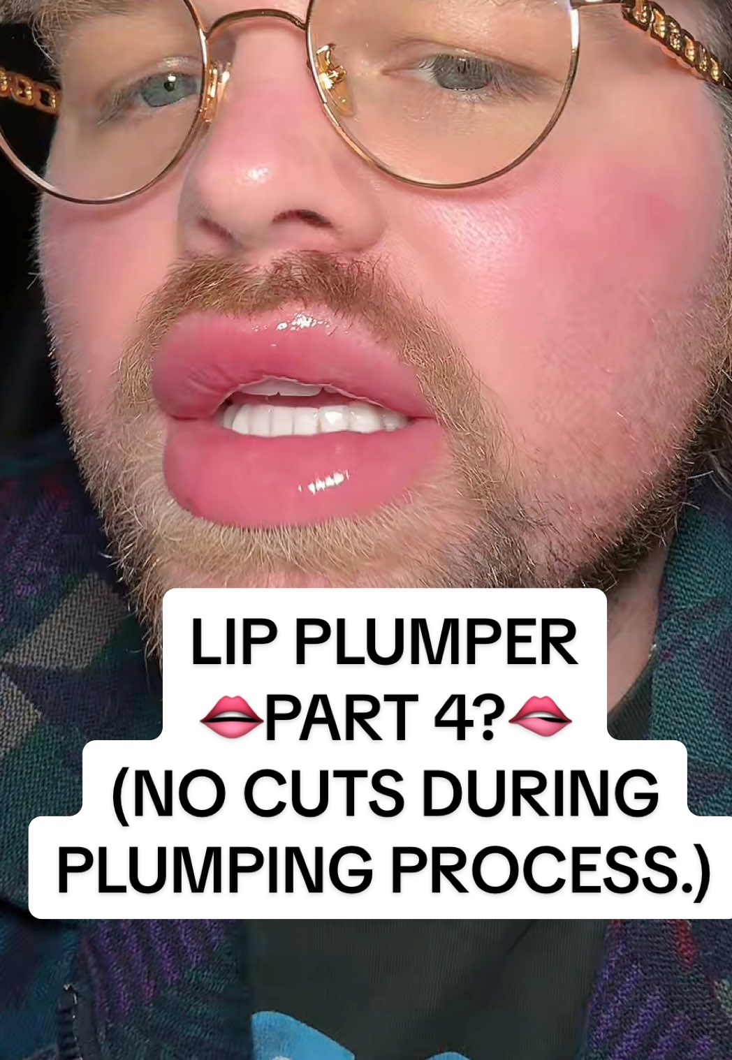 Replying to @Heather Elizabeth PART 4?? 👄🔥 Watch till end.. for real. #lipplumper #plumplips #lipfiller #lippies #lipprducts #drmelaxin #biospicule #lipshotmaxi #hardtouch #koreanin #koreanlips #koreanskincare #korea #painisbeauty #ttsstarcreator #TikTokShop #tiktokshopfinds #giftidea #giftsforher #giftsforhim #tiktokshopmademebuyit #TikTokShopCreatorPicks #tiktokmademebuyit #fyp #flashsale #tiktokshopdeals #TTSLevelUp #TikTokShopSpringGlowUp #TikTokShopNewArrivals #TikTokShopMothersDay #TikTokShopMemorialDay @cocomintbeauty 