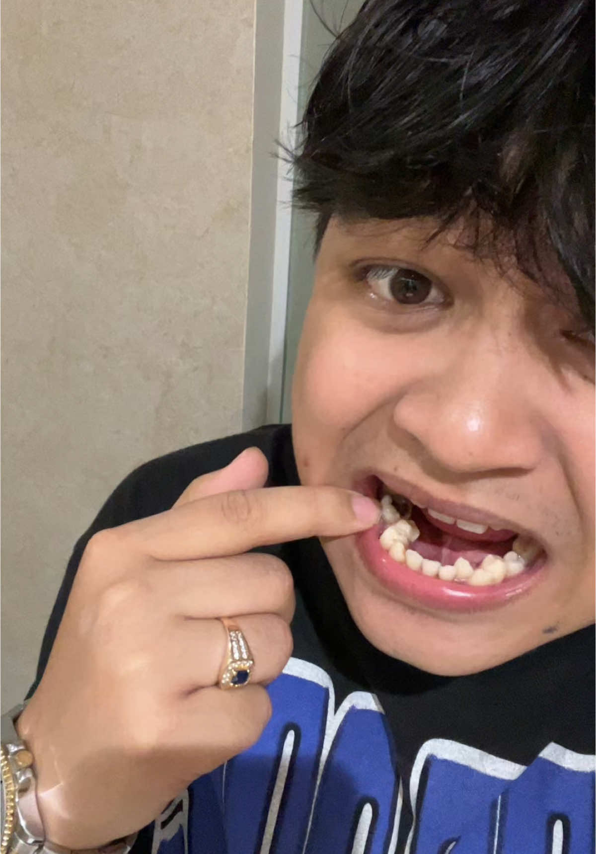 Untung ada obat kumur propolis
