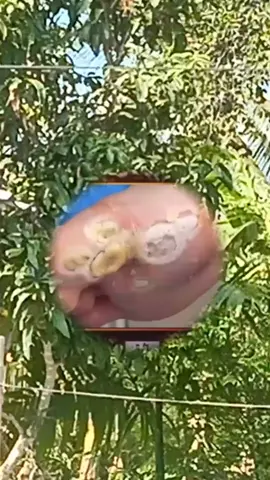 satisfying video cleaning #satisfying #satisfyingvideo #clean #cleaning #CleanTok #satisfyingcleaning #fyp #botfly #pimple #acne #skincare