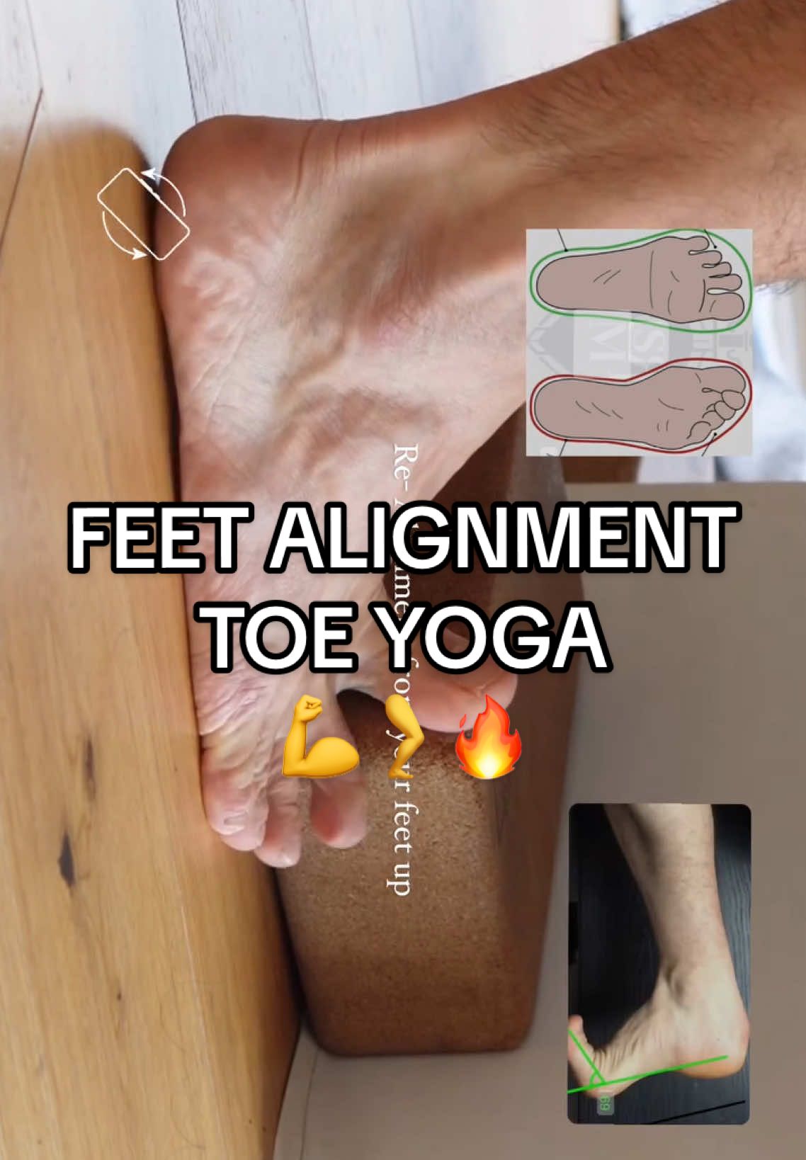 Feet correction🦵🫵🔥 - - - - - - #feetcare #feetpain #stretching #flexibility #yoga #ramovement #toes 