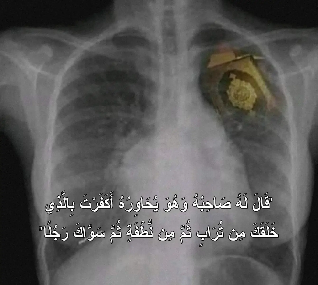 #القران_الكريم_راحه_نفسية😍🕋  #اللهم_صل_على_محمد_وآل_محمد  #المنشاوي 