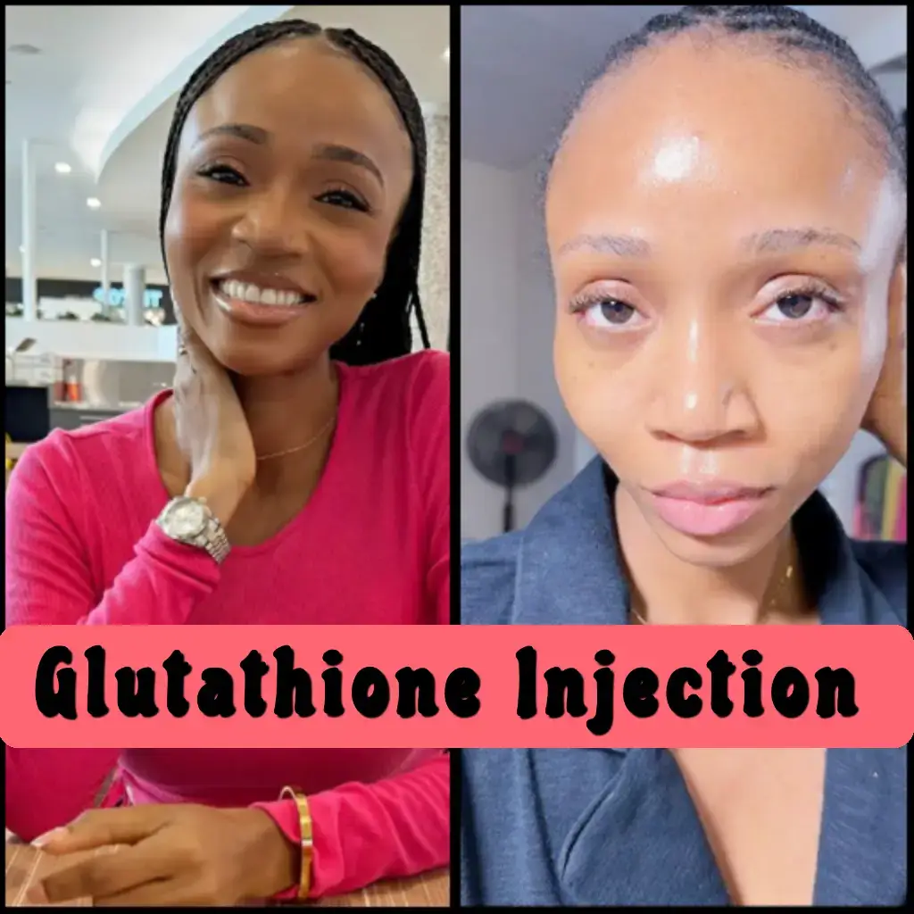 Skin Whitening with Glutathione Injections | Before & After Results