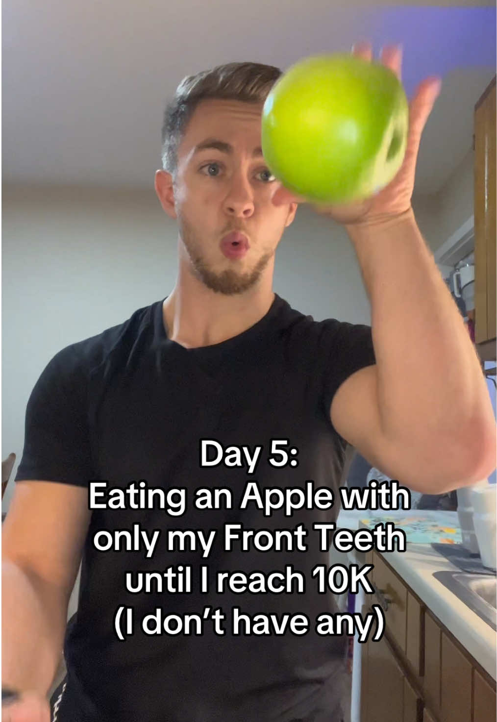 Day 5 of Eating an Apple with only my Front Teeth until I hit 10K followers. Gums started bleeding. #fyp 