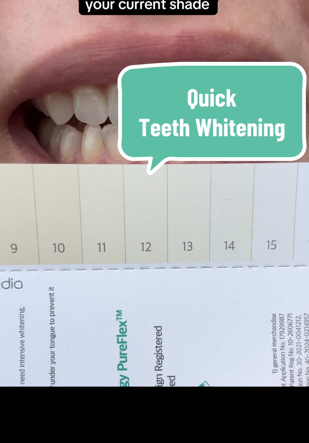 Pure Dia Teeth Whitening Gel Kit from Live Orals available on Bloomkare TikTok Shop! Very easy product to use. Slight irritation typical of teeth whitening systems but nothing unbearable. In one week I went from 11/12 shading to about 13/14. Very happy with the results! Benefits:  ✨Clinically Proven Whitening – Achieve up to 7.6 shades brighter teeth in 14 days with hydrogen peroxide-powered gel, removing tough stains from coffee, wine, and smoking.   ✨Complete At-Home Kit – Includes a shade guide, ergonomic mouthpiece, injector, and gauze for precise application, mess-free use, and easy tracking of whitening progress.   ✨Gentle & Effective Formula – Powered by Teraloba (hydrogen peroxide + lettuce extract) to whiten teeth without enamel damage or gum irritation, even for sensitive teeth. Product linked to this post!  @Bloomkare @Bloomkare Prize HQ    #Bloomkare #LiveOrals #PureDia #teethwhitening #gifted #bloomkaregiveaway #fyp #foryourpage #foryour #foru #for #forupage #forupageシ #foryoupage #foryoupageofficiall #foryoupage❤️❤️ #forupage #foruyou #viral #trending #beauty #skincare #makeup 