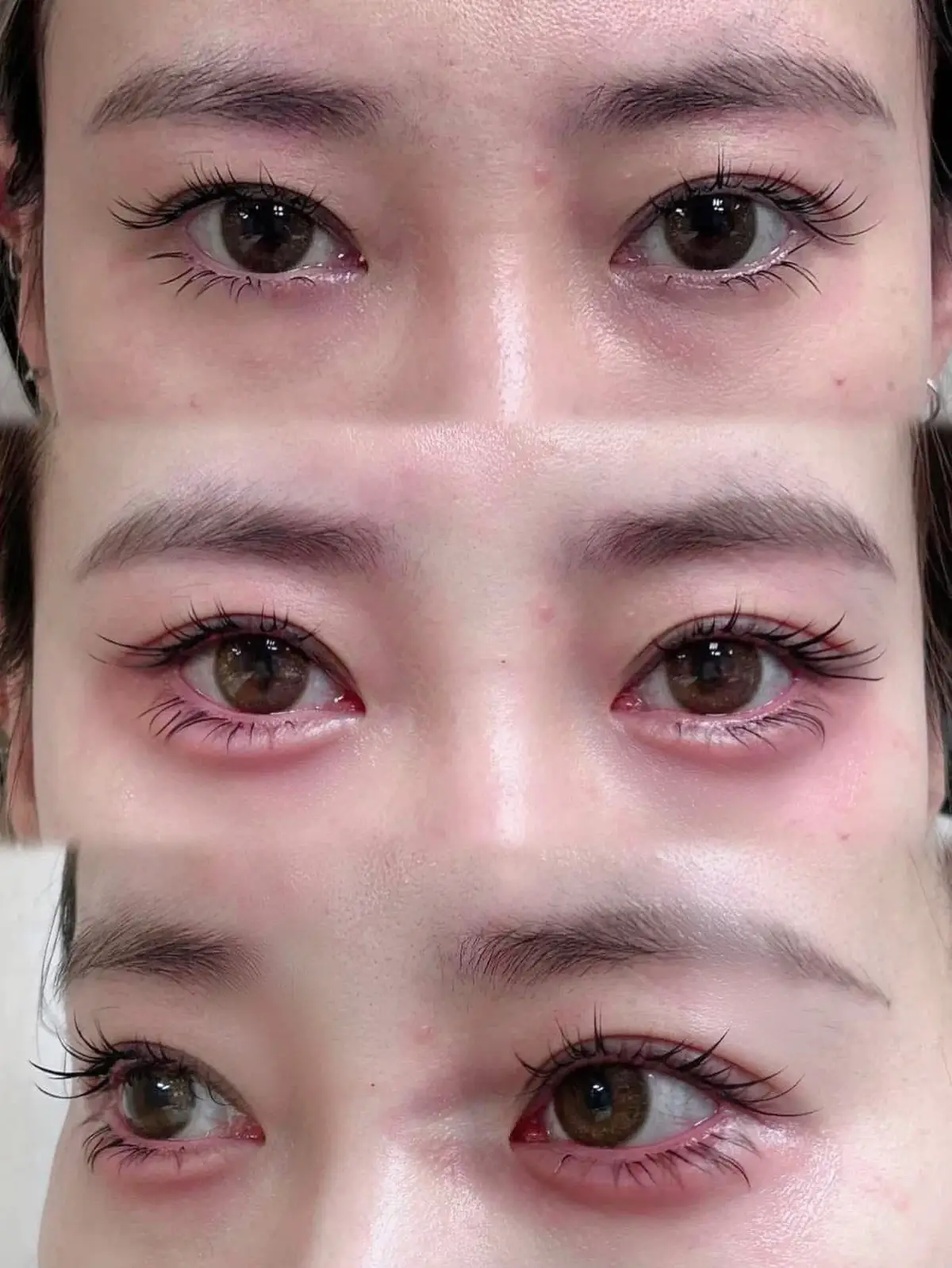 #xuhuong  #xuhuongtiktok  💉Tiêm Bọng mắt Cười “DOUYN” Trung Hoa hót lắm nè  I.b e chỉ từ 699 🌿 là có bọng mắt đẹp đi về 😍😍