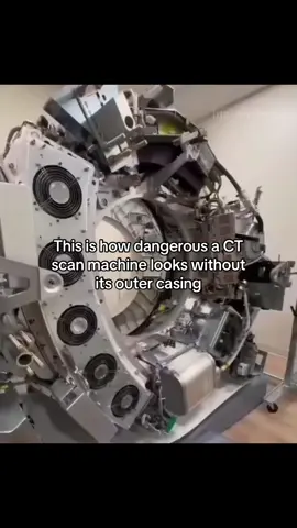 Ever wondered what a CT scanner looks like without its outer casing? This is it — and yes, it’s spinning at crazy speeds while quietly scanning your insides with precision. Kinda looks like something out of a sci-fi horror movie, right? Now imagine lying inside this thing while it’s whirring like that… Would you still be chill, or are you hopping off the table?” #CTScan #MedicalMachines #BehindTheScenes #EngineeringMarvel #CreepyCool #XRayTech #TechWithNoShell #SpinningScience #SciFiOrReality #C#CTScannerM#MedicalImagingR#RadiologyT#TechUncoveredM#MachineWithoutSkinE#EngineeringD#DiagnosticTechC#CreepyMachinesN#NakedMachineS#SpookyScienceH#HospitalTechS#SpinToWinM#MedicalEngineeringW#WhatLiesBeneathF#FuturisticVibesO#OpenMachineH#HighSpeedScanU#UncasedTechS#SciFiMachineTechReveal #f#fypf#foryouf#foryoupagev#viralt#trendingx#xyzbcat#tiktoktrende#explorepagef#fypシf#fypツt#tiktokdailyf#funnyvideosfypppppppppppppppppppppppppppppp  #r#relatablem#mustseew#watchtillendc#cooltechwow 🔥IG: (Experimentsforyou123) 🔥❌I do NOT own this video. All credits to original owner. Dm for credits or removal ❌