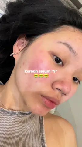korban serum virall 👀😭 serius deh jd super mulusss tapi…