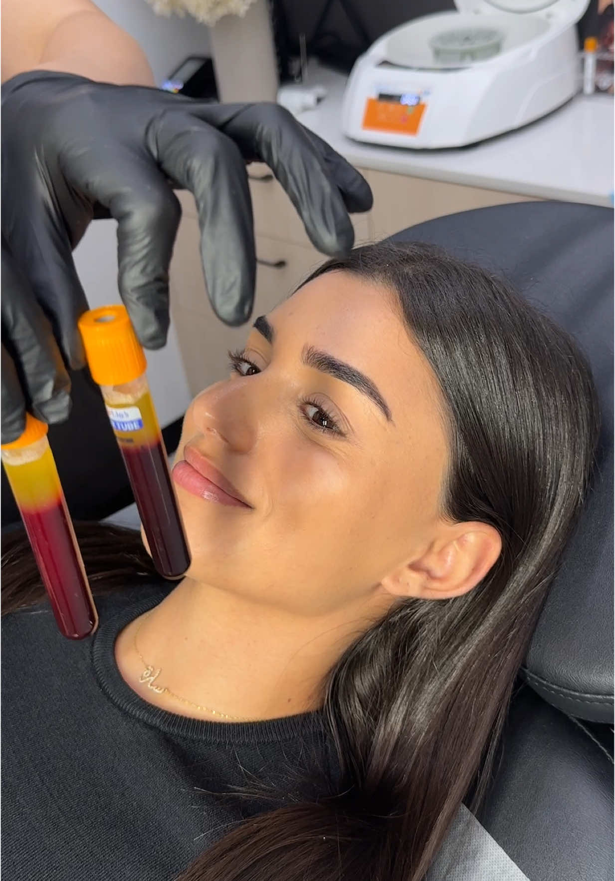 Revitalize your under-eye area with PRF treatment – a natural, rejuvenating solution that helps reduce dark circles and fine lines, leaving you with refreshed, youthful-looking skin. Consultations are available via our website www.mappaesthetics.com.au  Important Information 1: Individuals result will vary. 2: All non-surgical treatments carry risk and the potential of side effects.  3: A full consultation is required prior to treatment for suitability, risks, benefits & outcomes. 4: Content is to be considered educational and not medical advice. Always ensure you are informed prior to consenting to any treatment. #HairPRP #HairRestoration #FemaleHairCare #NonInvasiveTreatment #HealthyHair #HormonalHairLoss #PostpartumHairLoss #PostMenopauseHair #sydneyprp #prphairclinics 