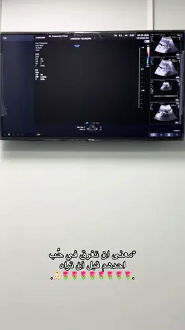 ومن شفتها صار الحب اضعاف😢🩷 #ملاذ #CapCut #CapCutAmor #love♥️ #GamingOnTikTok #wheretovisit #sportsontiktok🏐 