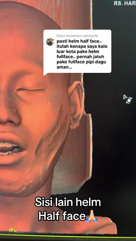 Membalas @satrioy46  Helm half face aja ginj, apalagi yg ga pake helm kan😌😭 semoga kita dijauhkan dari marabahaya aamiin #accident #ctscan #radiologi 
