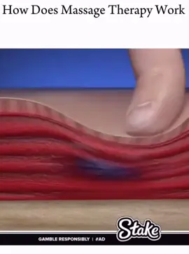 Trigger point hay còn gọi là điểm kích hoạt là nguồn gốc của những cơn đau cơ kéo dài dai dẳng nếu bạn không xác định và “tháo gỡ” đúng cách. Có thể hình dung đơn giản như thế này. Các sợi cơ trong cơ thể chạy song song với nhau, trigger point là các nút thắt trong các sợi cơ đó. Các sợi cơ này kết dính với nhau tạo thành “nút thắt”. Nếu không “gỡ” các nút thắt này, chúng sẽ làm sự chuyển động của các cơ này bị “tắc nghẽn” và gây ra đau đớn. Cơn đau có thể xảy ra ở ngay nút thắt hoặc các vùng có liên quan. Các điểm trigger point thường tồn tại trong các mô mềm, xuất hiện nhiều nơi trên cơ thể. Nếu không được giải quyết chúng sẽ làm các hệ cơ bị co cứng, gây đau đớn trong trạng thái căng cơ liên tục. Phương pháp điều trị: châm cứu (acupuncture, moxibustion) kết hợp giải cơ bằng tay (massage theraphy) N𝒉𝒂̣̂𝒏 𝒕𝒖̛ 𝒗𝒂̂́𝒏 𝒎𝒊𝒆̂̃𝒏 𝒑𝒉𝒊́ để tìm ra hướng điều trị phù hợp với tình trạng của bạn. #yhct #hue #xuhuong #acupuncture 
