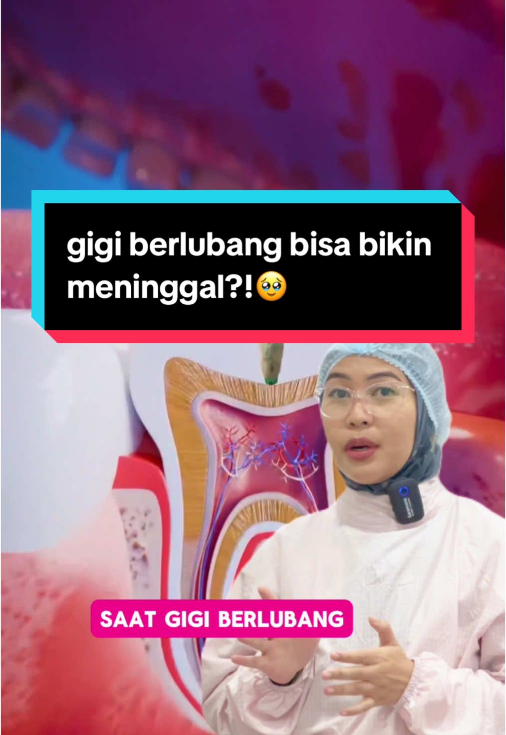 gara-gara gigi bolong bisa bikin meninggal?  ini penjelasannyaa, segera cek ke @Klinik Gigi Terbaik yaa kalau punya gigi berlubang, biar ga makin parah🥹🥹 #maesadental #gigibolong #sakitgigi #cekgigi